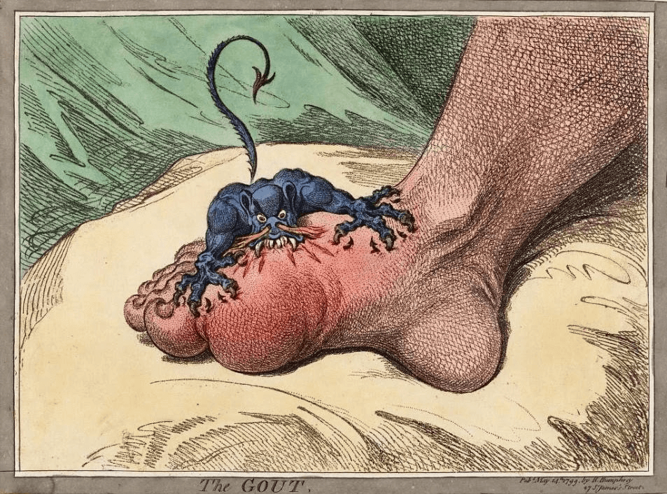 The Gout. James Gillray