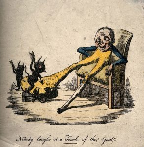 Gout sufferer