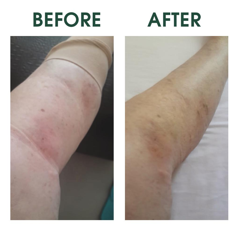 Circuwell Circulation Booster before and After