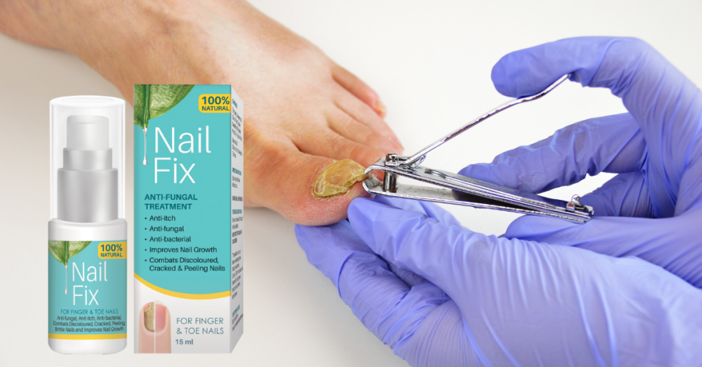Treatment of toe nail fungal infections with Nail Fix